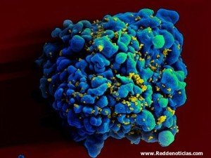 HIV-infected H9 T cell