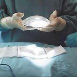 NEGLIGENCIA CIRUGIA ESTETICA