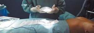 NEGLIGENCIA-CIRUGIA-ESTETICA