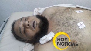 Muere joven que resultó herido durante atraco en la calle Restauración de Santiago