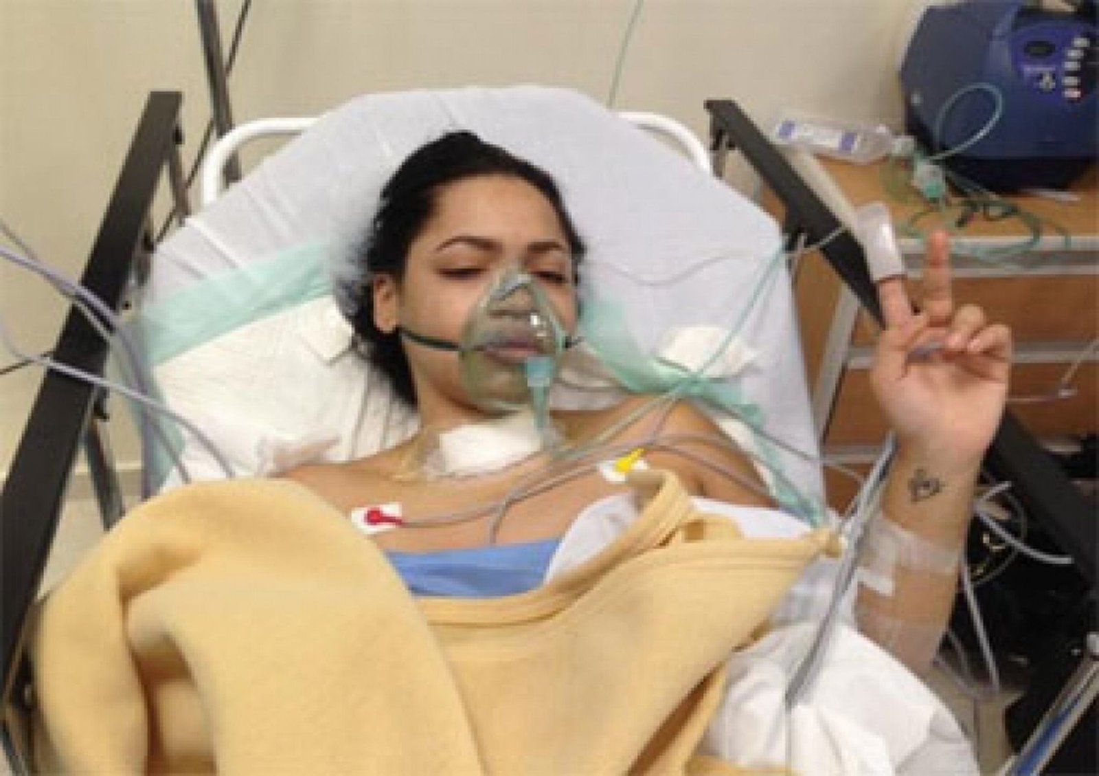 juliana oneal operada