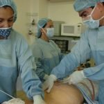 Operacion