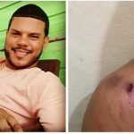 dos heridos en enfrentamiento a tiros entre seguidores del prd y pld en monte cristi
