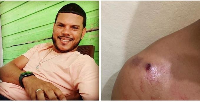 dos heridos en enfrentamiento a tiros entre seguidores del prd y pld en monte cristi